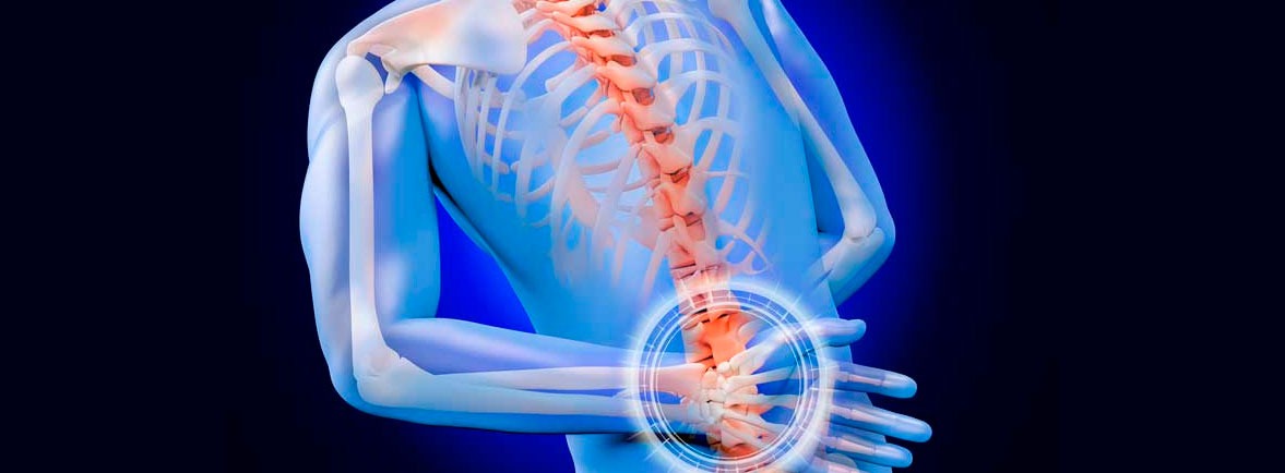 Espondilitis anquilosante, no es un trabalenguas, es una enfermedad reumática