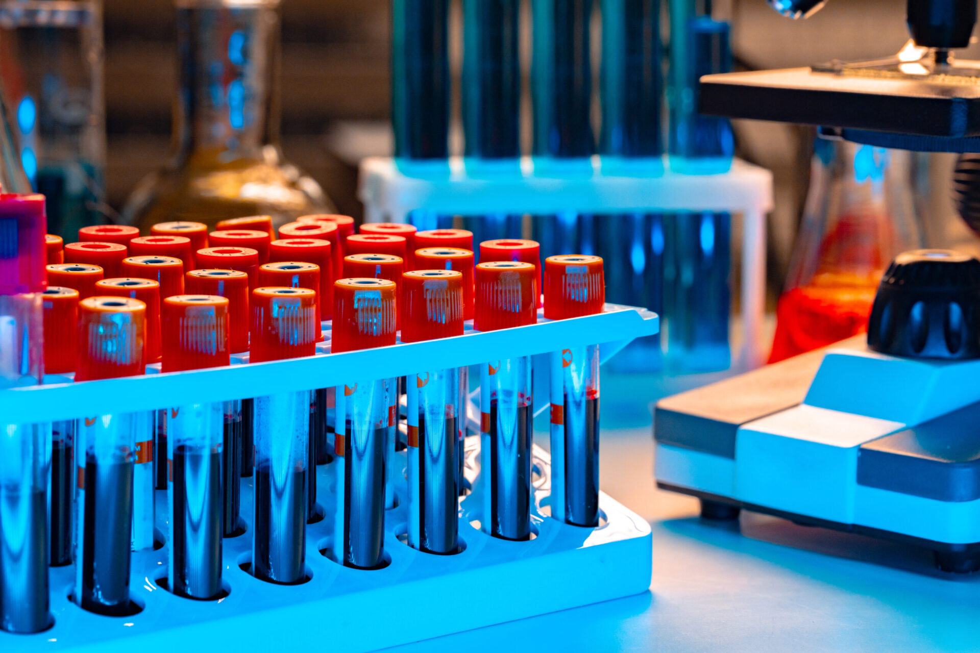Análisis clínicos especializados en reumatología