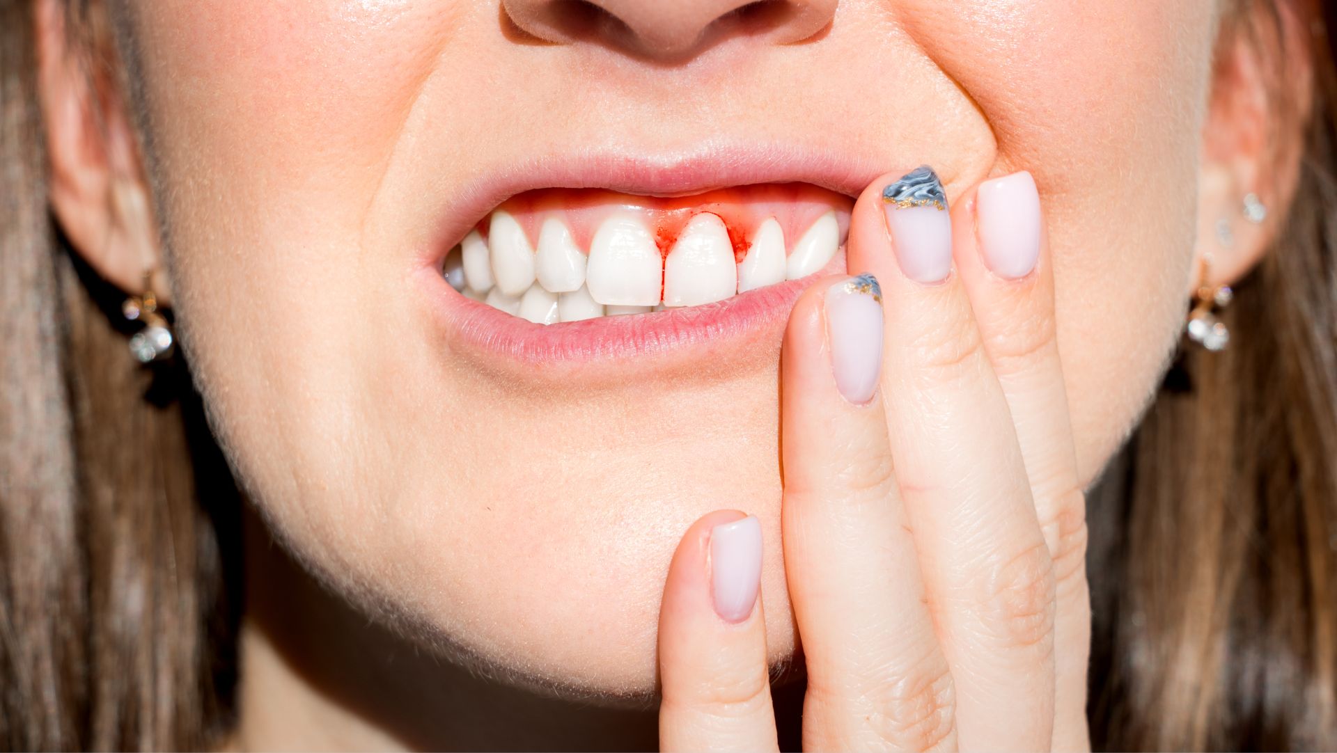 ¿Qué tiene que ver la higiene dental con las enfermedades reumáticas?