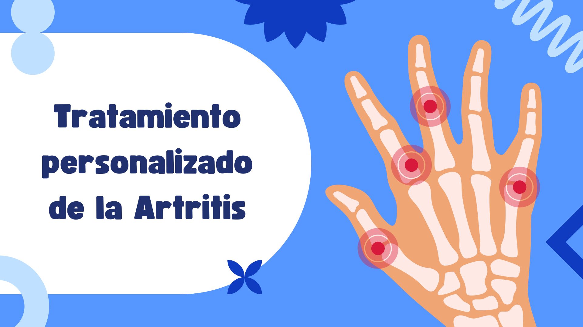 Tratamiento personalizado de la Artritis Reumatoide