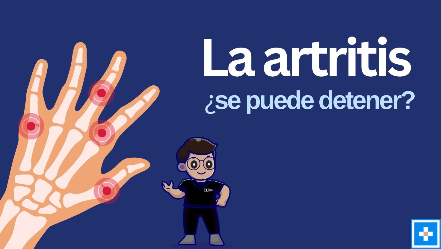 ¿La artritis se puede detener? Opciones de tratamiento que sí funcionan
