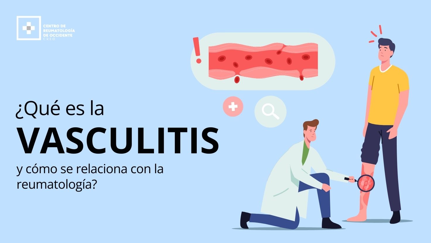 vasculitis