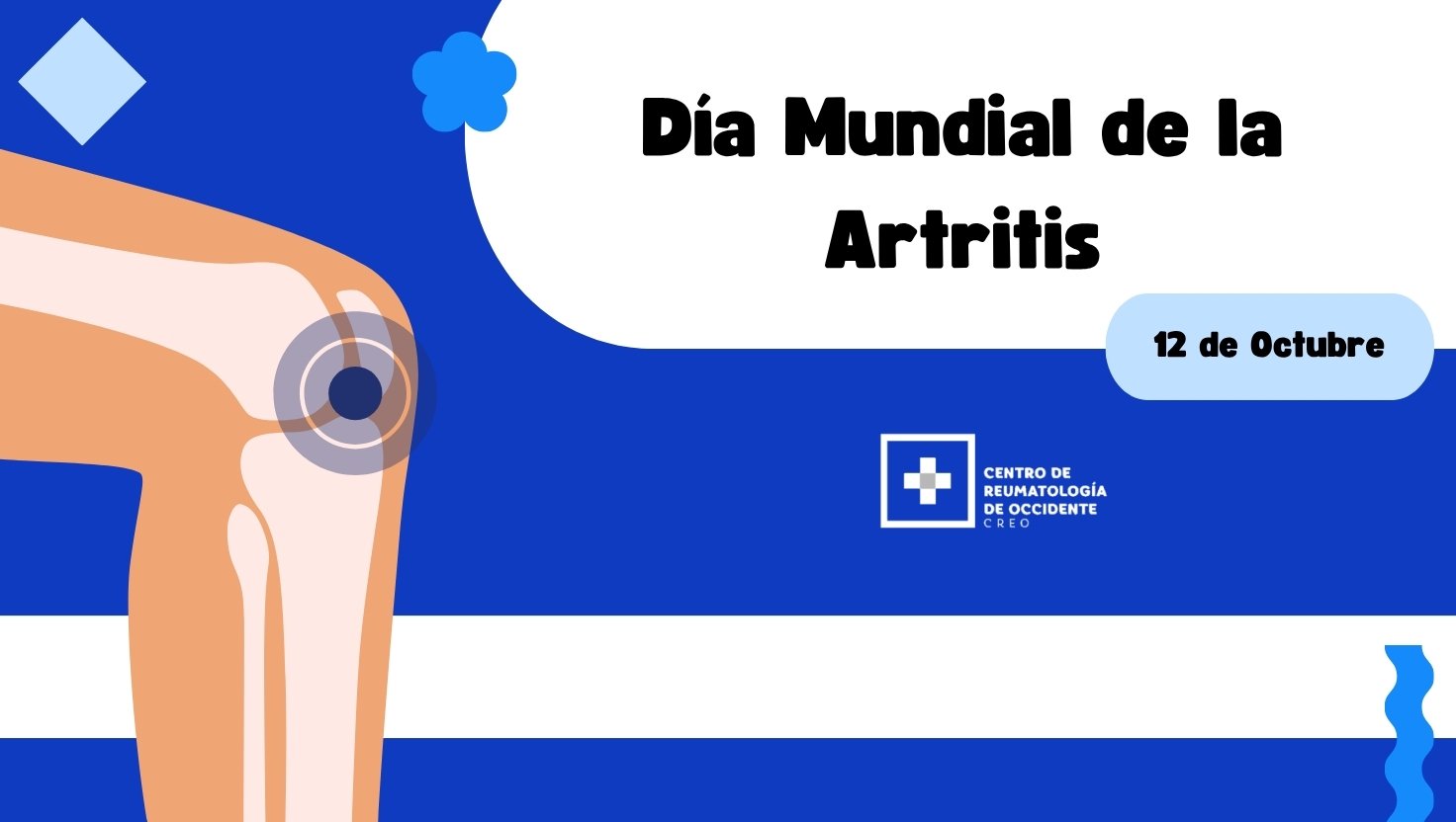 Día Mundial de la Artritis: avances en el diagnóstico y tratamiento de la artritis reumatoide
