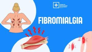 Fibromialgia: síntomas que muchas personas ignoran